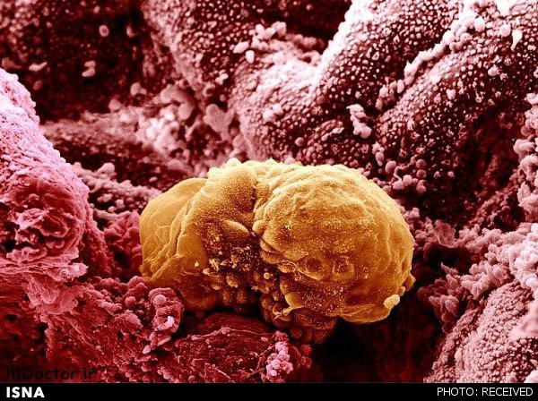 ارائه روشی موثر برای درمان سرطان سینه ارائه روشی موثر برای درمان سرطان سینه