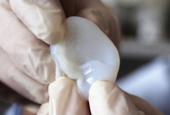 تولید گوش مصنوعی با چاپ ۳ بعدی تولید گوش مصنوعی با چاپ ۳ بعدی