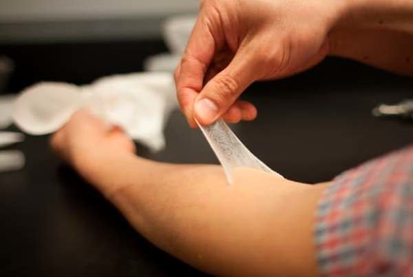 تولید پوست نامریی برای رفع چین و چروک تولید پوست نامریی برای رفع چین و چروک