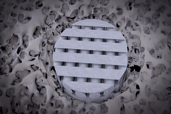 ساخت غضروف با پرینتر سه بعدی ساخت غضروف با پرینتر سه بعدی