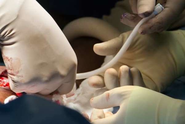 ساخت عروق خونی آزمایشگاهی برای بیماران دیالیزی ساخت عروق خونی آزمایشگاهی برای بیماران دیالیزی