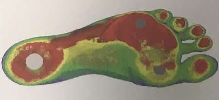 کفی الکتریکی برای اصلاح خودآگاهانه راه رفتن