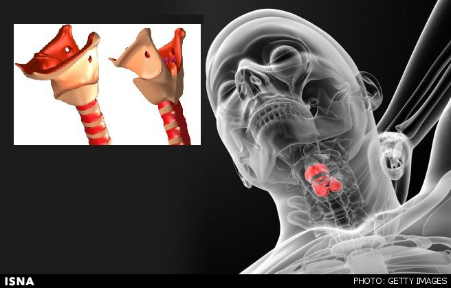 تشخیص بیماری از روی صدا