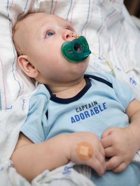 مغز بیرون زده به جمجمه بازگشت! مغز بیرون زده به جمجمه بازگشت!