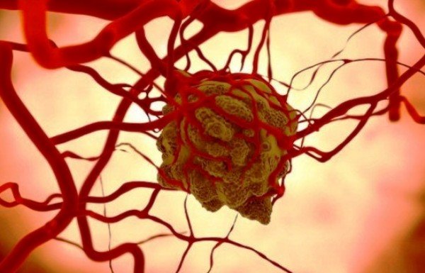 کلید درمان سرطان و بیماریهای قلبی در یک ژن کلید درمان سرطان و بیماریهای قلبی در یک ژن