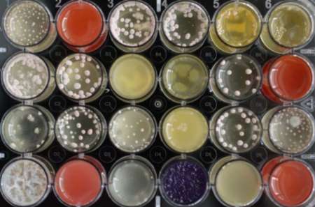 کاهش مقاومت آنتی بیوتیکی با نوعی قارچ کمیاب کاهش مقاومت آنتی بیوتیکی با نوعی قارچ کمیاب