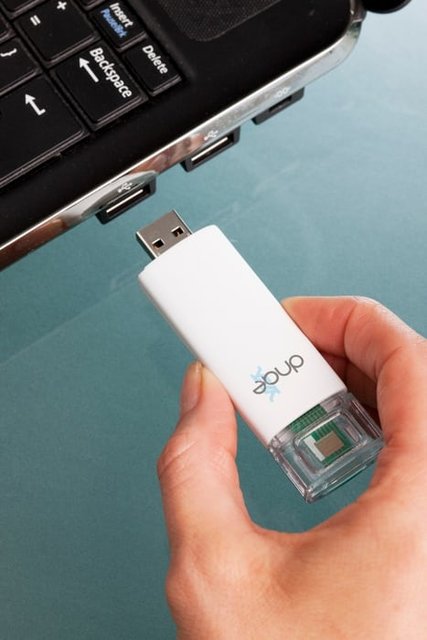 تشخیص 30 دقیقه‌ای اچ.آی.وی با استفاده از «یواس‌بی»