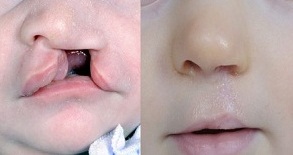 آن روی سکه پزشکان در ایران: «نمایش انسانیت» از سیستان و بلوچستان تا کرمانشاه