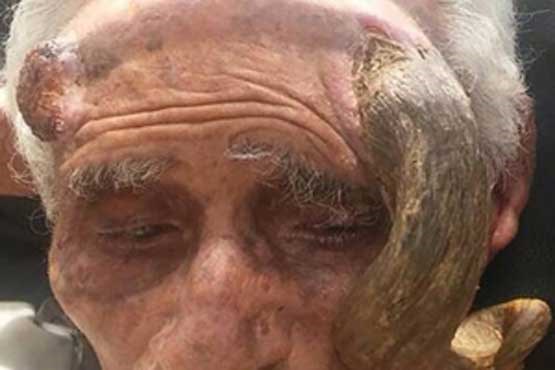 شاخی که موجب مرگ پیرمرد 140 ساله شد! (+عکس)