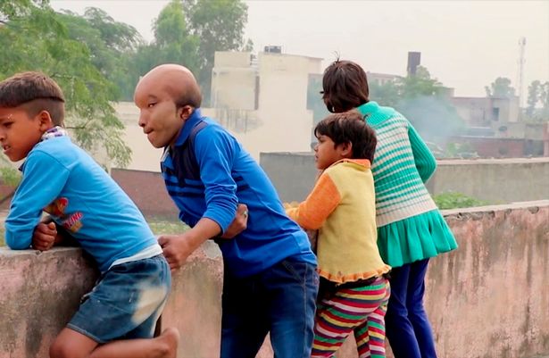 تغییر چهره جوان عجیبالخلقه هندی برای یافتن همسر (+عکس) تغییر چهره جوان عجیبالخلقه هندی برای یافتن همسر (+عکس)