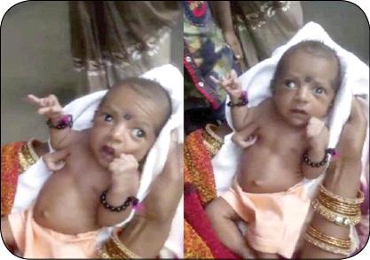 تولد کودکی در هند با 3 دست! (+عکس)