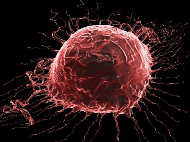 اهمیت تشخیص زود هنگام سرطان اهمیت تشخیص زود هنگام سرطان