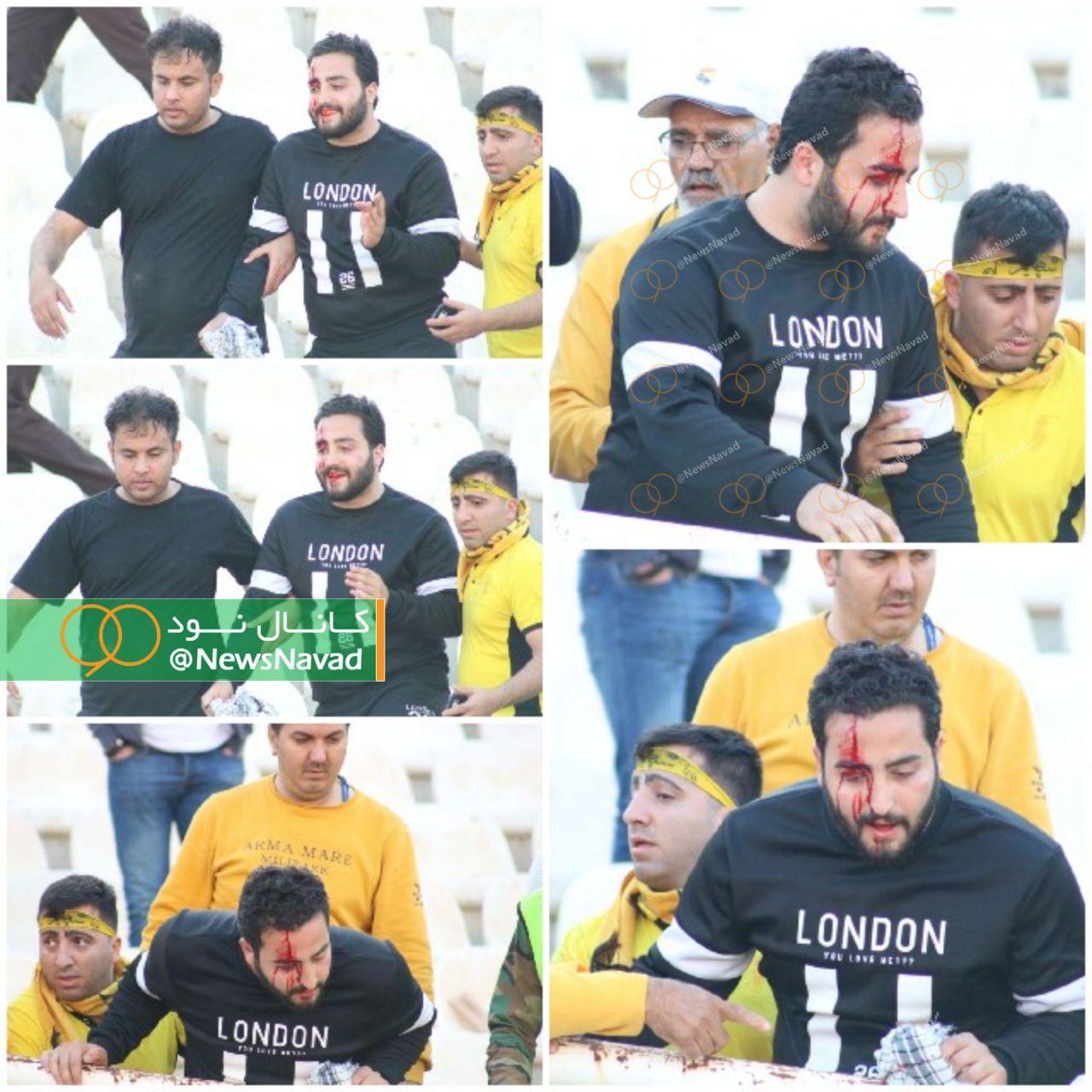 باز هم سنگ و خون در غدیر اهواز (عکس) باز هم سنگ و خون در غدیر اهواز (عکس)