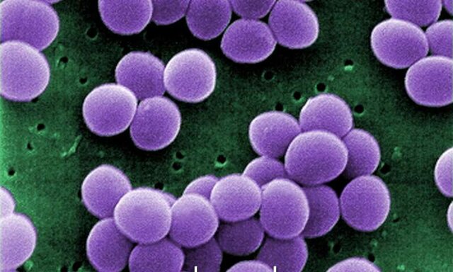 نقش ویتامین D در پیشگیری از ابتلا به عفونت