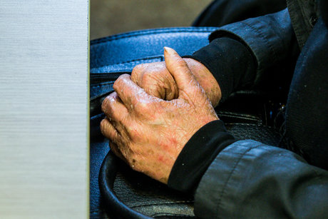 بیماران نادر 