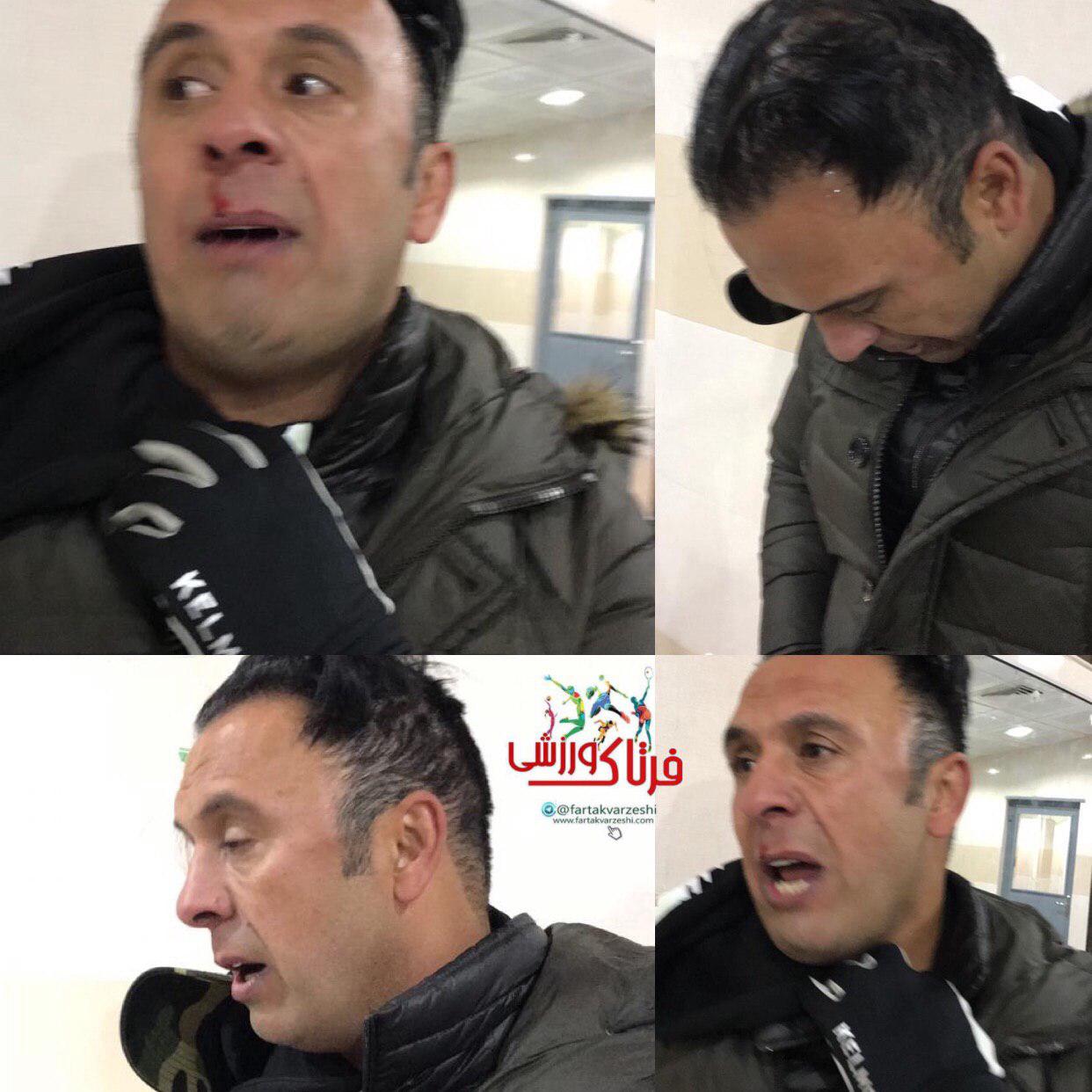 درگیری در لیگ دو/ بینی سرمربی شهرداری ماهشهر شکست (+عکس) درگیری در لیگ دو/ بینی سرمربی شهرداری ماهشهر شکست (+عکس)