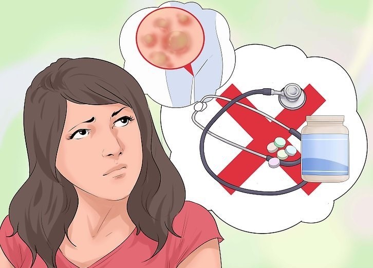 زگیل تناسلی در زنان