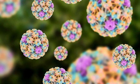 کلینیک سرطان عصر ایران/ بروزرسانی مهر ۹۸