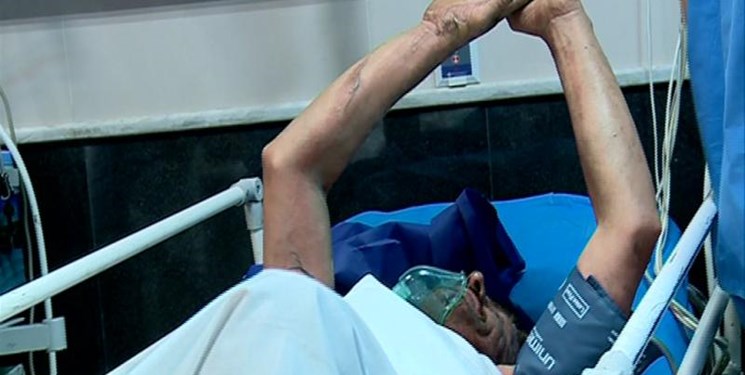 سوختگی در ایران 8 برابر متوسط جهانی