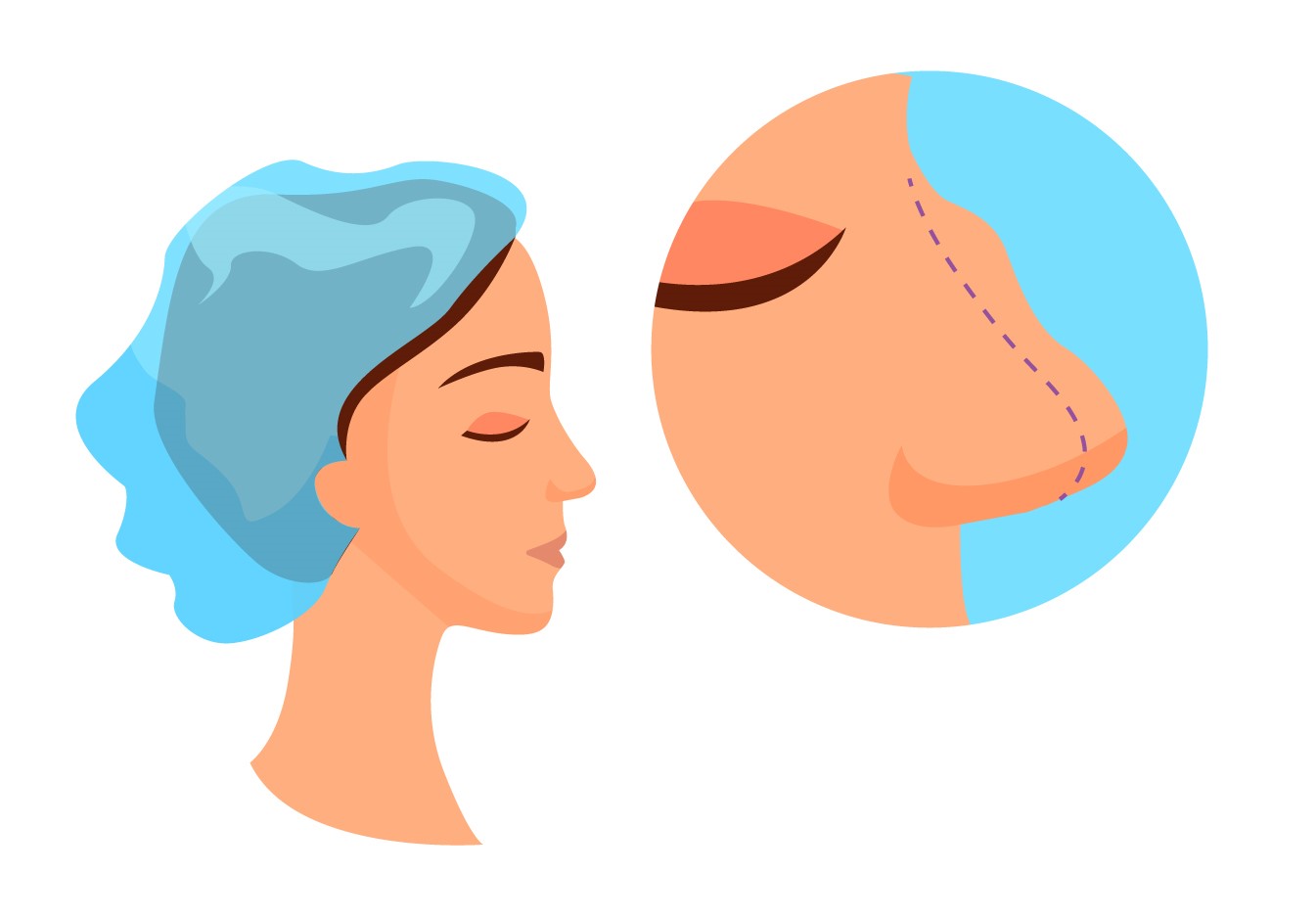 8 باور غلط در مورد عمل بینی 8 باور غلط در مورد عمل بینی