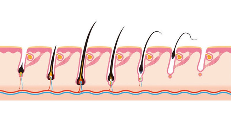 بهترین روش درمان ریزش موی سر