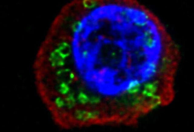 کرم‌های انگلی