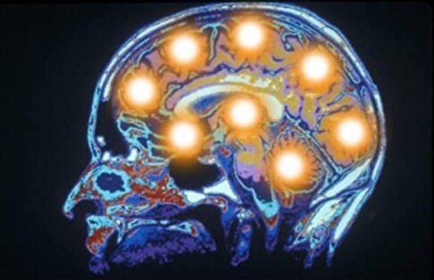 مثبت‌اندیشی با گوش‌دادن به موسیقی کیهانی 