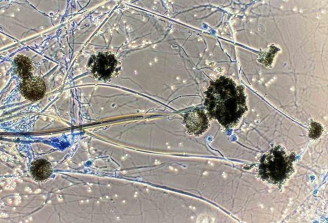 قارچ سیاه و دانستنیهایی درباره آن قارچ سیاه و دانستنیهایی درباره آن