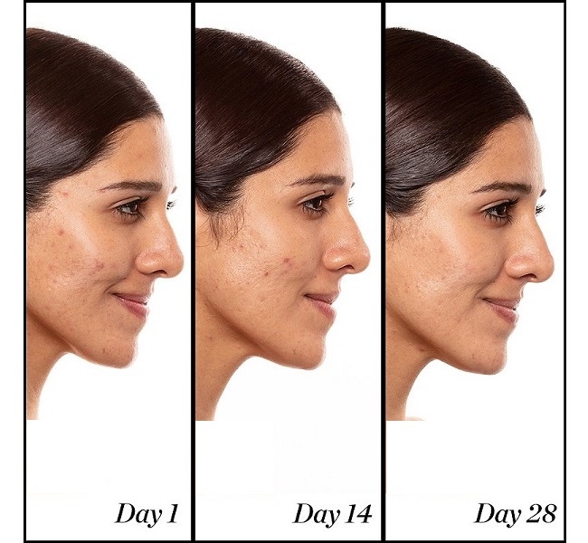 همراه با رتینول؛ یکی از محبوب ترین ترکیبات مراقبت از پوست همراه با رتینول؛ یکی از محبوب ترین ترکیبات مراقبت از پوست