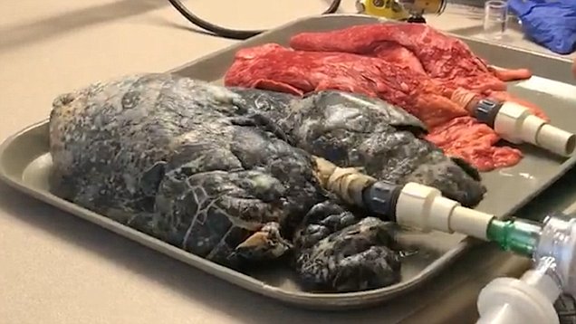 تاثیر سیگار کشیدن بر ریه‌ها به روایت تصویر