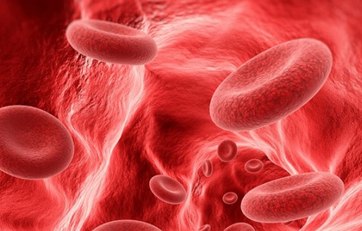 نقش گروه خونی در خطر بروز سکته زودهنگام