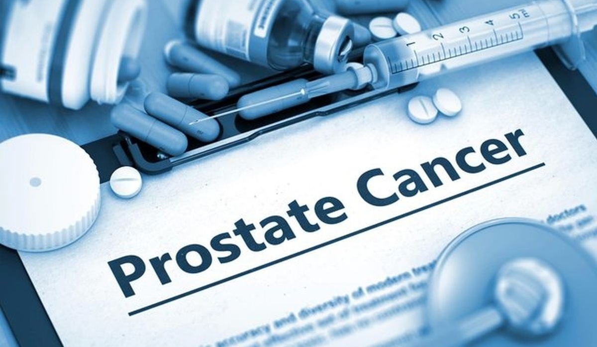 ۷ توصیه برای جلوگیری از بروز سرطان پروستات