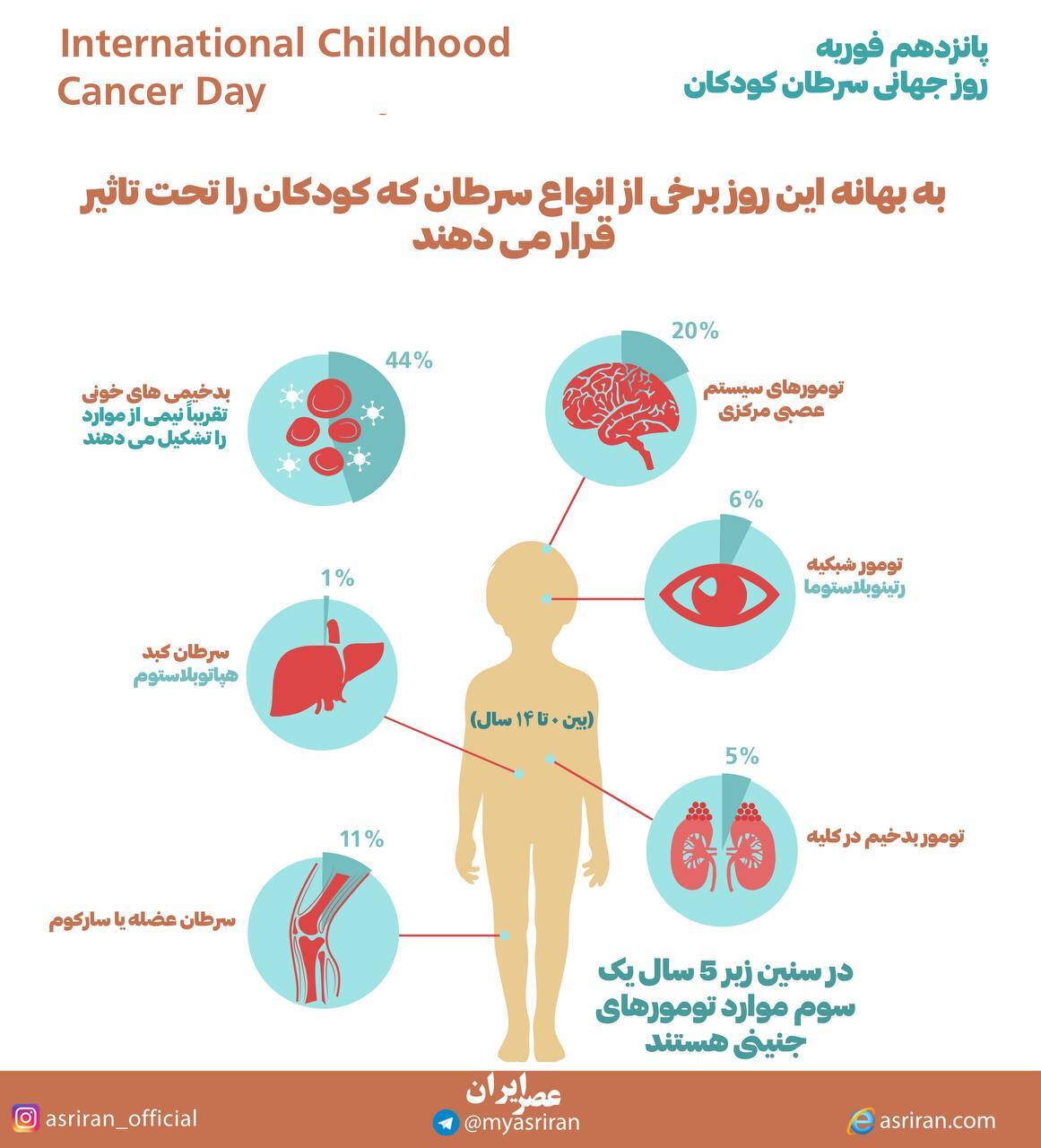 15 فوریه روز جهانی سرطان کودکان (اینفوگرافیک)