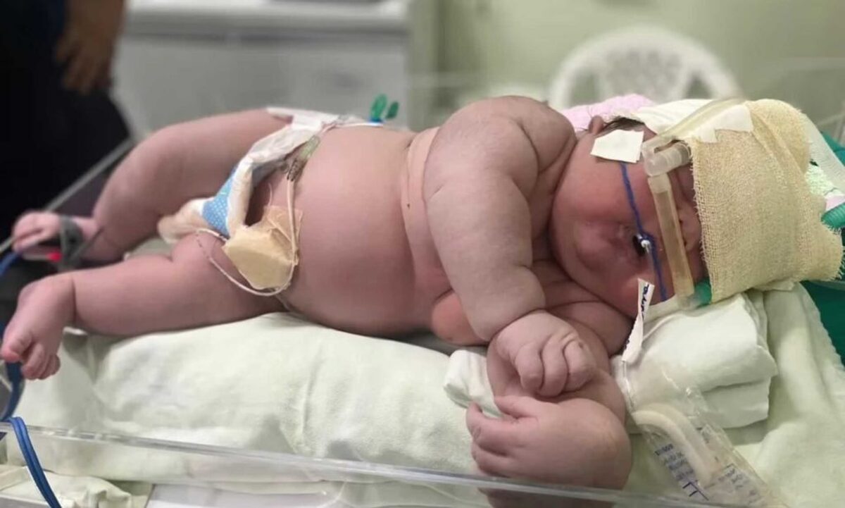 نوزادی ۷ کیلوگرمی با ۶۰ سانتیمتر قد در برزیل به دنیا آمد (+عکس)