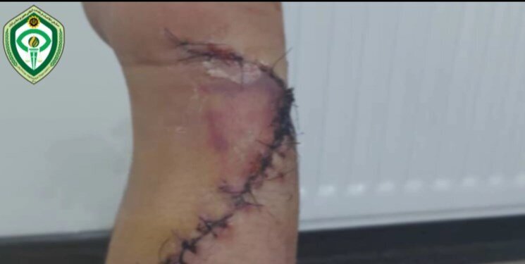حمله خونین اراذل در بریانک؛ نقص عضو یک شهرون/ دستی که پزشکان پیوند زدند (+تصاویر ۱۶+)