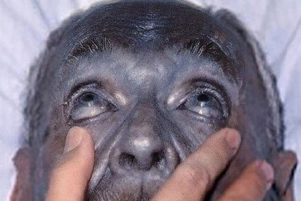 آواتارها در دنیای واقعی؛ مردمانی که آبیپوست هستند! (عکس) آواتارها در دنیای واقعی؛ مردمانی که آبیپوست هستند! (عکس)