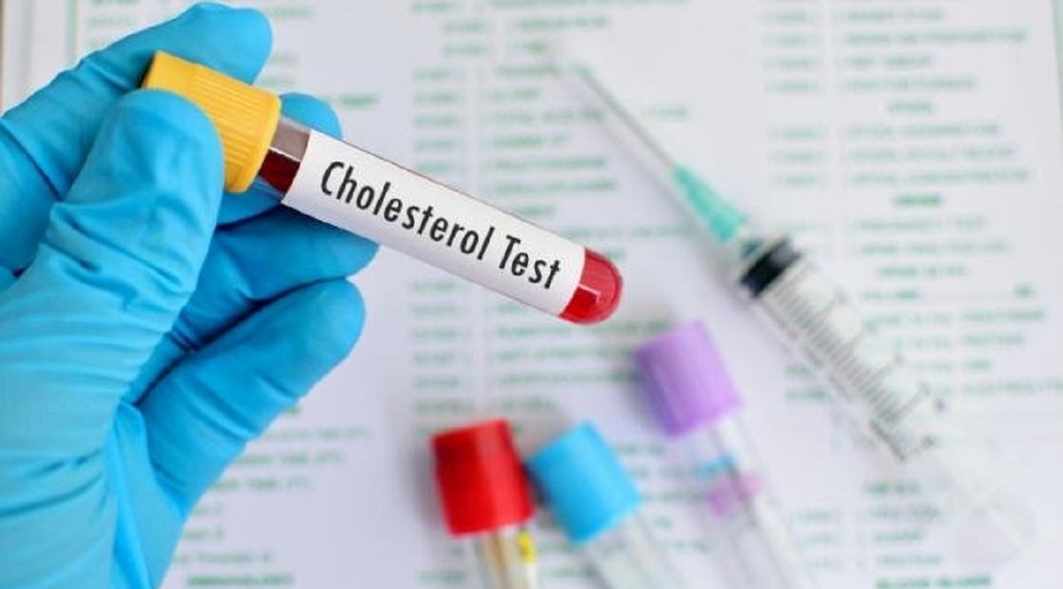 خوراکی‌هایی که کلسترول را پایین می‌آورند