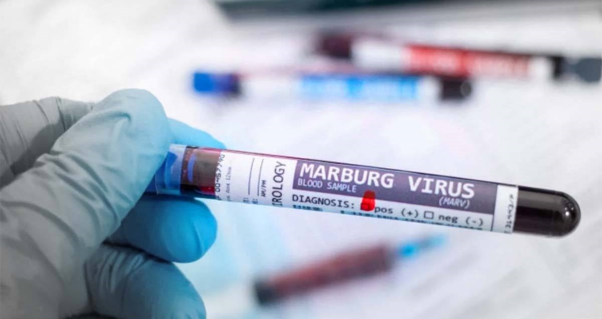ویروس جدید ماربورگ در اروپا/ احتمال شیوع در اسپانیا