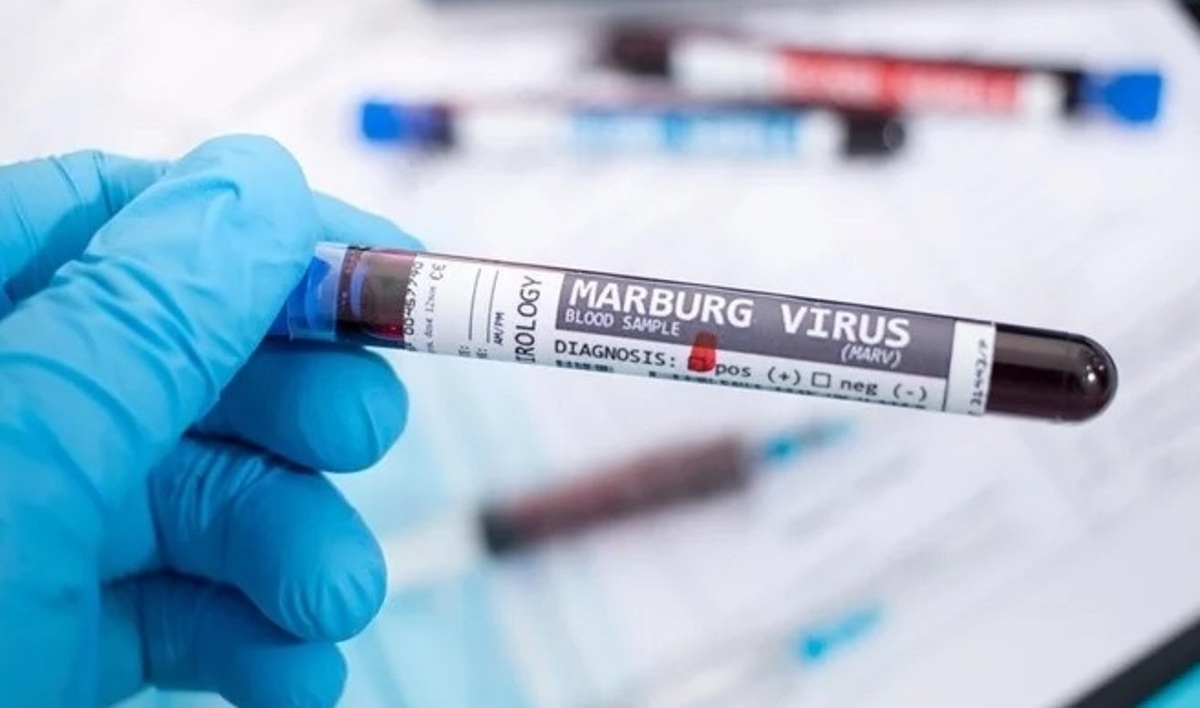 وزارت بهداشت: «ویروس ماربورگ» هنوز تهدیدی برای ایران نیست/ این ویروس واکسن ندارد