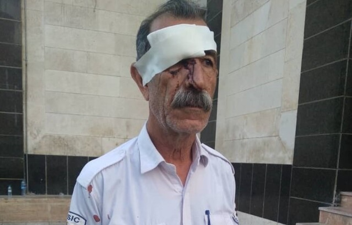 کرمانشاه/ ضرب و شتم تکنسین اورژانس از سوی همراهان یک بیمار