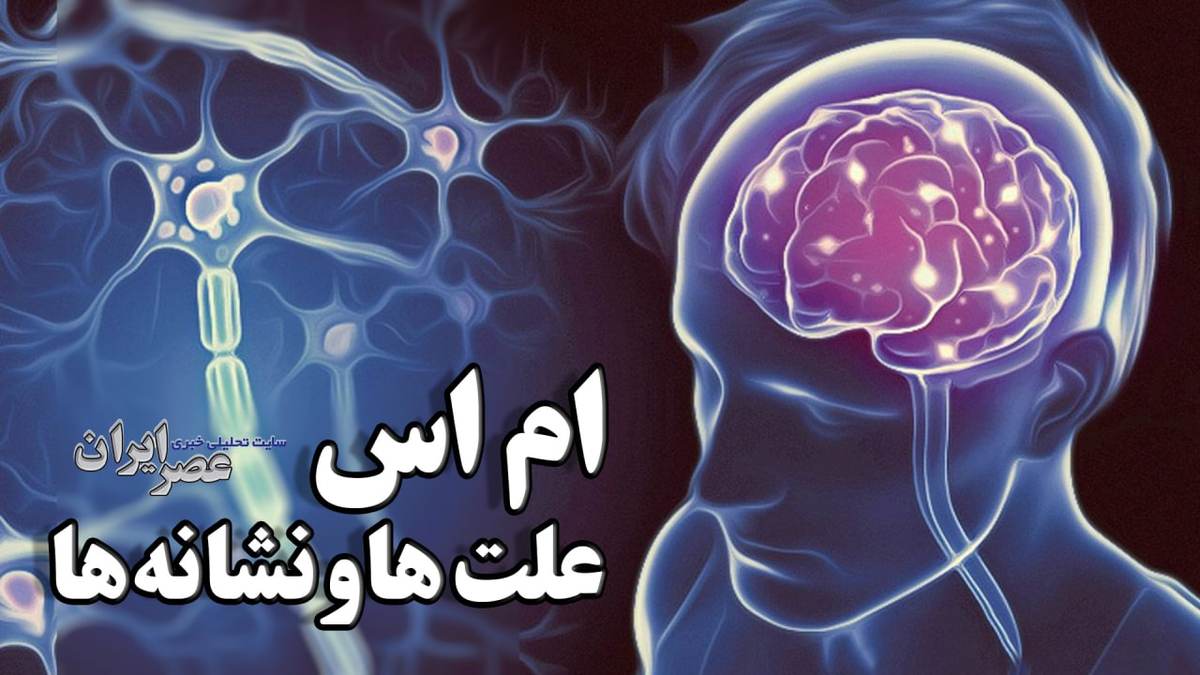 همه چیز درباره بیماری قرن جدید: ام اس ، نشانه ها و علائمی که اگر زود متوجه بشوید نجات می یابید/ چه افرادی بیشتر مبتلا می شوند و راهکارهای درمان (فیلم)