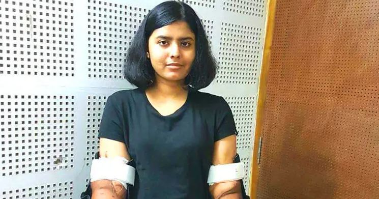 حیرت پزشکان از زنانه شدن دست های یک مرد پس از پیوند به دختر ۱۸ ساله