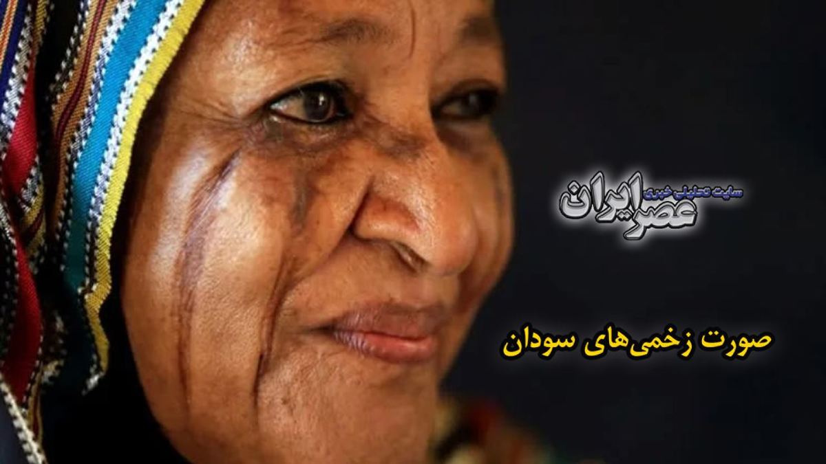 ببینید| صورت زخمی‌ها در سودان/ سنت عجیبی که در آن با تیغ به جان صورت می‌افتند