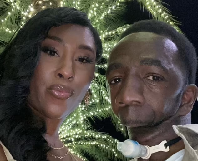 ازدواج عجیب اما عاشقانه یک زن با مردی که فک و چانه ندارد ازدواج عجیب اما عاشقانه یک زن با مردی که فک و چانه ندارد