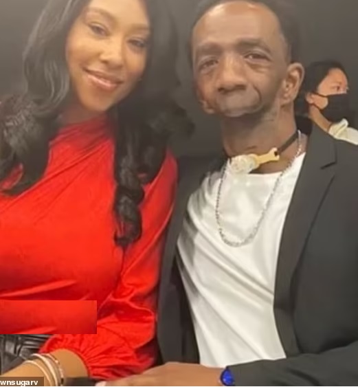 ازدواج عجیب اما عاشقانه یک زن با مردی که فک و چانه ندارد ازدواج عجیب اما عاشقانه یک زن با مردی که فک و چانه ندارد