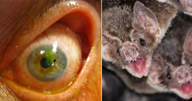 ۱۳ روش درمانی عجیب و غریب در طول تاریخ؛ از خمیر موش تا مربای جنازه ۱۳ روش درمانی عجیب و غریب در طول تاریخ؛ از خمیر موش تا مربای جنازه