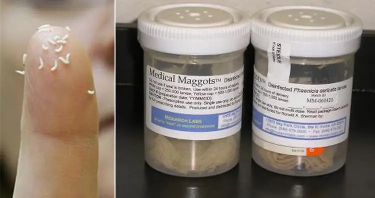 ۱۳ روش درمانی عجیب و غریب در طول تاریخ؛ از خمیر موش تا مربای جنازه ۱۳ روش درمانی عجیب و غریب در طول تاریخ؛ از خمیر موش تا مربای جنازه