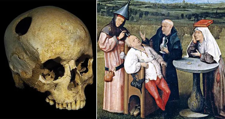 ۱۳ روش درمانی عجیب و غریب در طول تاریخ؛ از خمیر موش تا مربای جنازه ۱۳ روش درمانی عجیب و غریب در طول تاریخ؛ از خمیر موش تا مربای جنازه