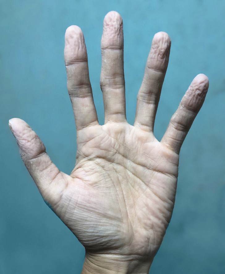 ۱۱ نشانه هشدار دهنده در بدن که نباید به آن ها بی اعتنا بود