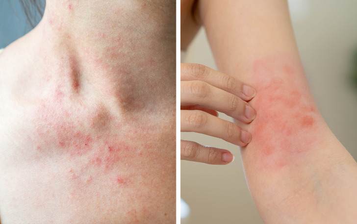 ۱۱ نشانه هشدار دهنده در بدن که نباید به آن ها بی اعتنا بود